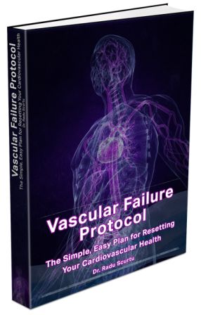 Vascular Failure Protocol ebook cover