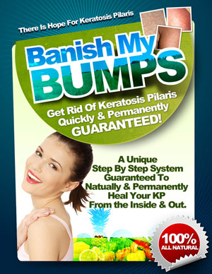 Banish My Bumps book cover