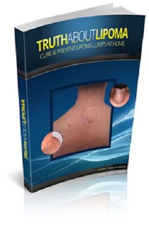 Truth About Lipoma book cover