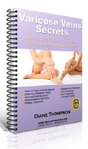 Varicose Veins Secrets ebook cover